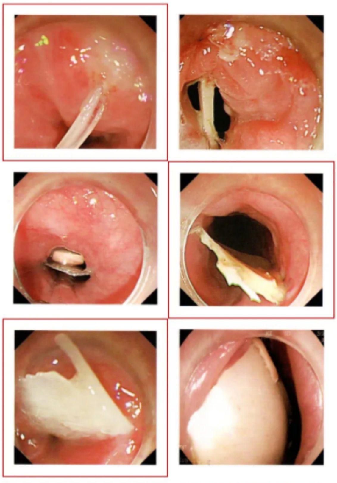 acvsd(3)